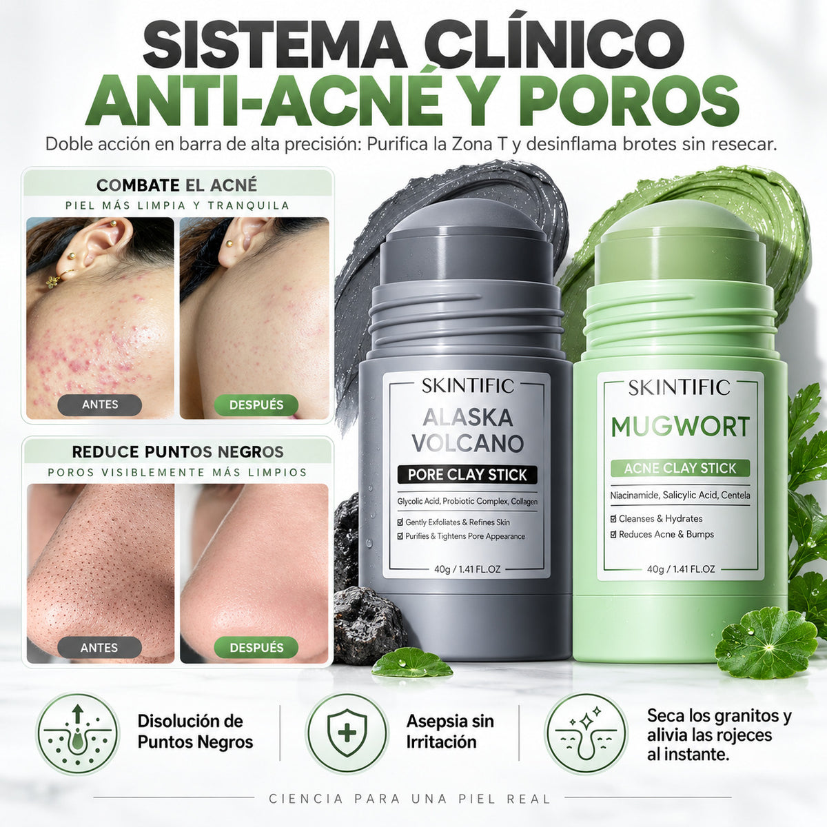 Reduce tus brotes y puntos negros en solo 14 días
