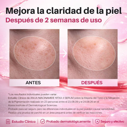 Despídete de las manchas que arruinan tu piel… y vuelve a mirarte con confianza en el espejo