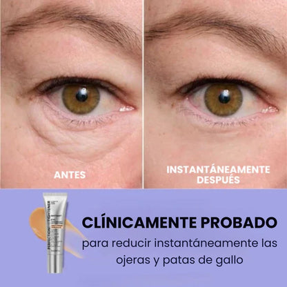Reduce visiblemente bolsas y ojeras en solo 5 minutos sin tratamientos costosos