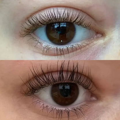 ForChics pestañas y cejas mas largas en 2 semanas