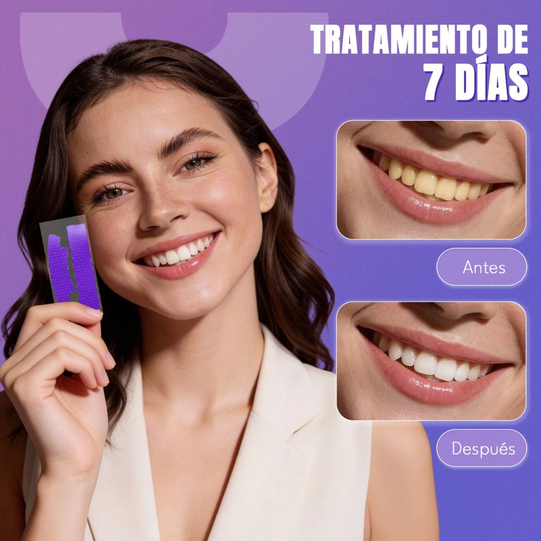 Desmancha tus dientes en 30 minutos sin ir al dentista ni gastar miles de pesos - 42 tiras