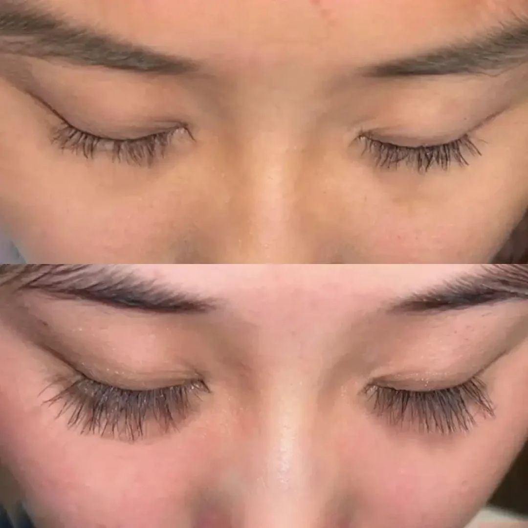 ForChics pestañas y cejas mas largas en 2 semanas