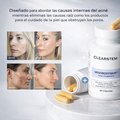 Mindbodyskin® – Apoya el equilibrio interno de tu piel para una apariencia más limpia y saludable