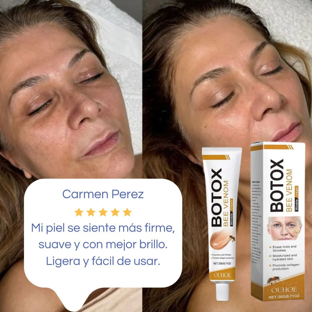 Recupera la Firmeza de Tu Piel y Reduce Arrugas Visibles en Solo 10 Días