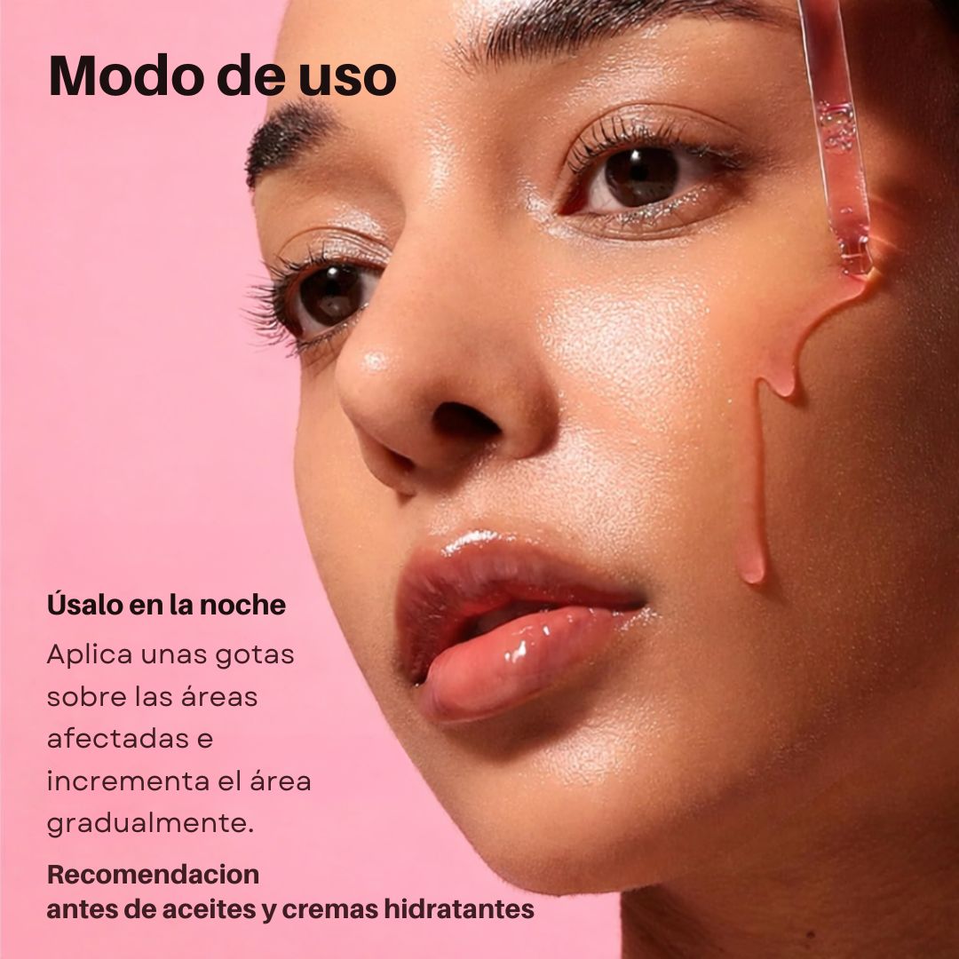 Despídete de las manchas que arruinan tu piel… y vuelve a mirarte con confianza en el espejo