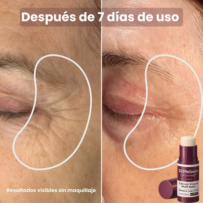 Face balsamo reafirmante, antiedad, elimina arrugas y lineas de expresion
