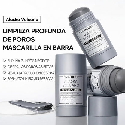 Reduce tus brotes y puntos negros en solo 14 días