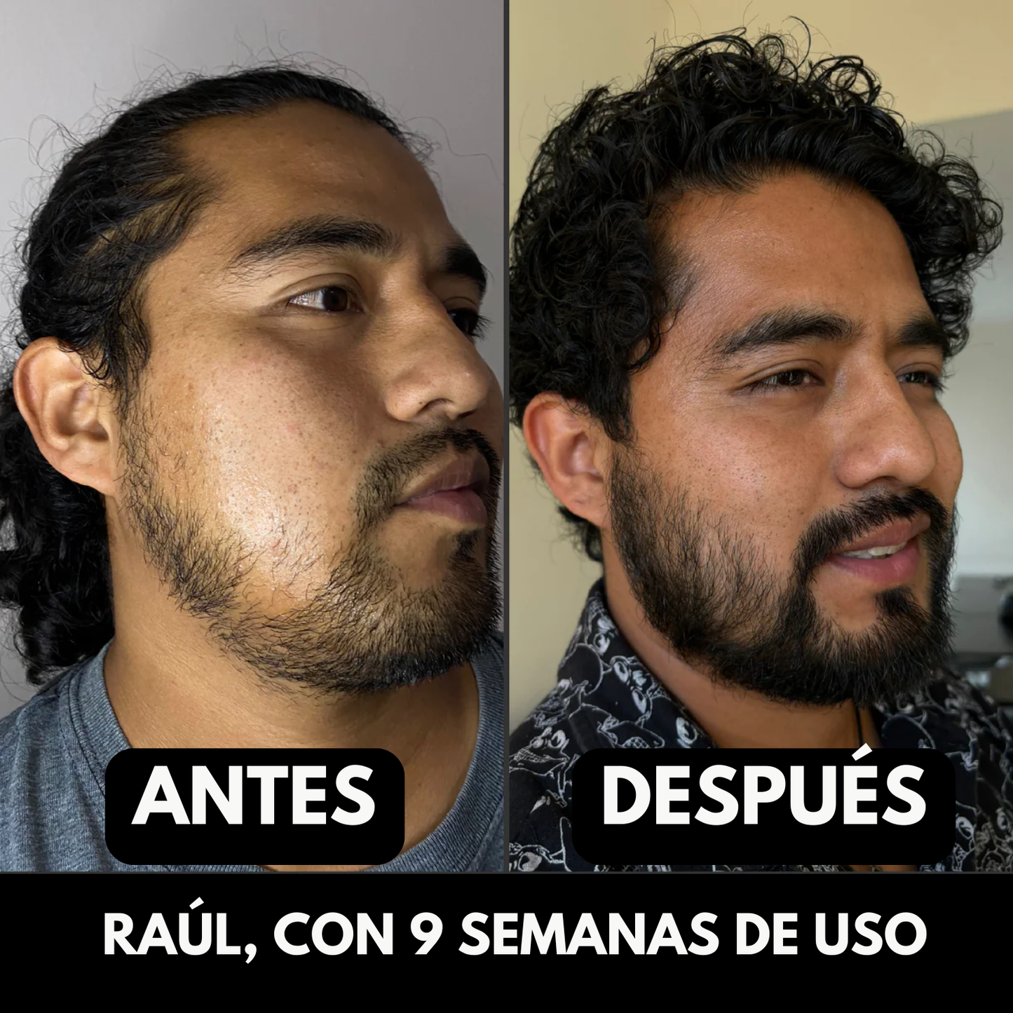 Empieza a notar una barba con mejor apariencia en pocas semanas