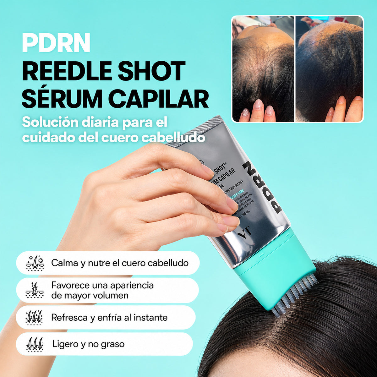 Hair PDRN Recupera la fuerza y el volumen de tu cabello desde la raíz