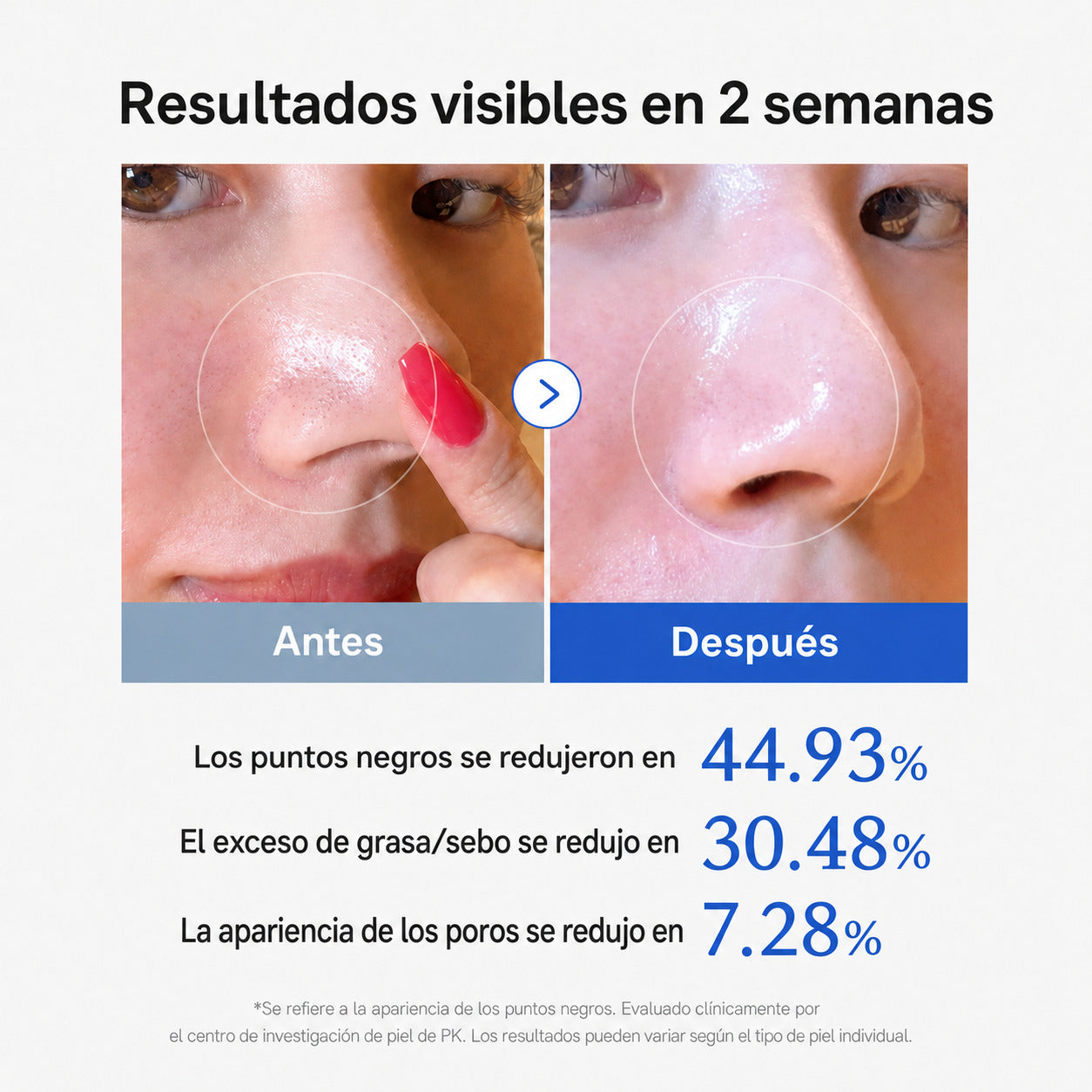 Destapa tus poros sin lastimar tu piel