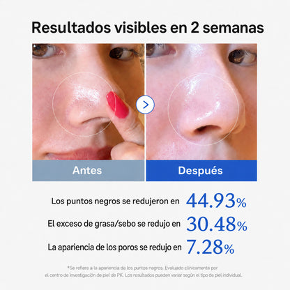 Destapa tus poros sin lastimar tu piel