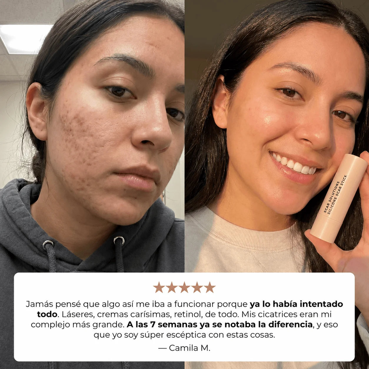 Stick Reparador de cicatrices de acne