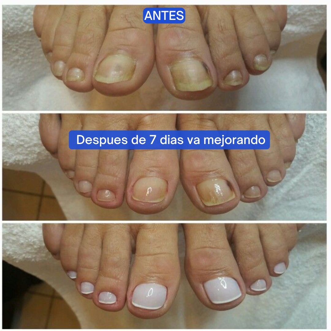 Vuelve a mostrar tus pies sin sentir vergüenza