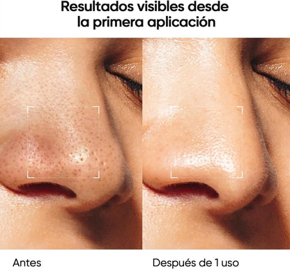 Reduce tus brotes y puntos negros en solo 14 días